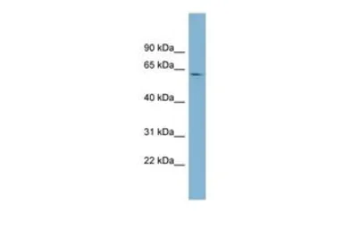 Anti-EPB41 antibody, Internal used in Western Blot (WB). GTX47066
