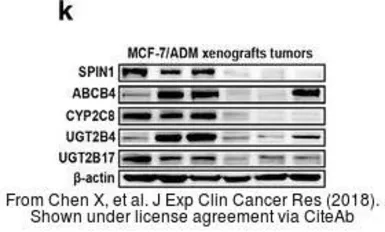 Anti-ABCB4 antibody, Internal used in Western Blot (WB). GTX47122