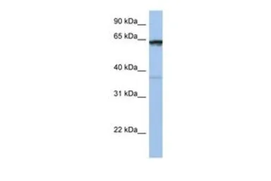 Anti-POPDC2 antibody, Internal used in Western Blot (WB). GTX47134