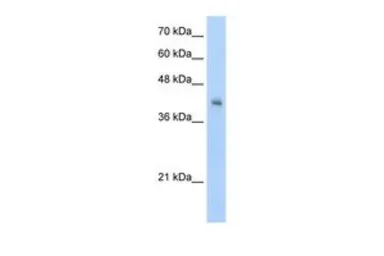 Anti-VSIG4 antibody, N-term used in Western Blot (WB). GTX47141