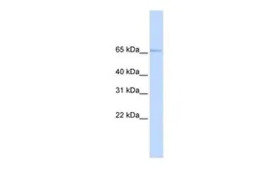 Anti-SLC22A6 antibody, N-term used in Western Blot (WB). GTX47148