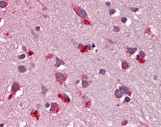 Anti-Wnt7b antibody, Internal used in IHC (Paraffin sections) (IHC-P). GTX47171
