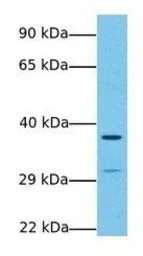 Anti-Wnt7b antibody, Internal used in Western Blot (WB). GTX47171