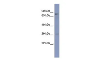 Anti-PURB antibody, N-term used in Western Blot (WB). GTX47237