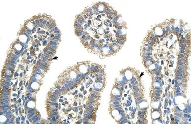 Anti-NXF5 antibody, Internal used in IHC (Paraffin sections) (IHC-P). GTX47238