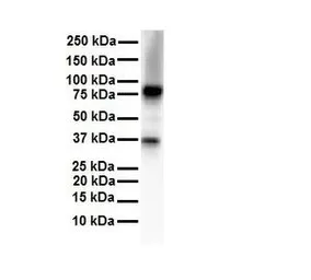 Anti-CPEB4 antibody, N-term used in Western Blot (WB). GTX47246