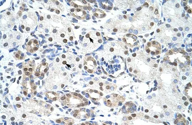 Anti-LSM2 antibody, Internal used in IHC (Paraffin sections) (IHC-P). GTX47264