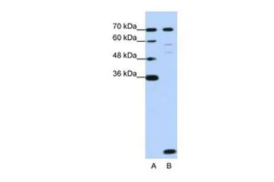 Anti-LSM2 antibody, Internal used in Western Blot (WB). GTX47264