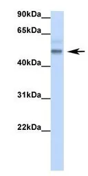 Anti-RBM47 antibody, Internal used in Western Blot (WB). GTX47272