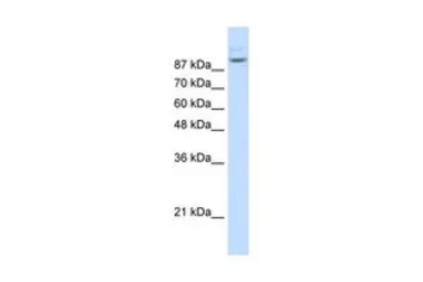 Anti-MATR3 antibody, N-term used in Western Blot (WB). GTX47279