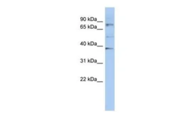 Anti-OAS2 antibody, N-term used in Western Blot (WB). GTX47299