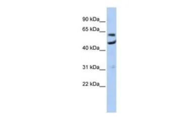 Anti-CNOT6 antibody, N-term used in Western Blot (WB). GTX47309