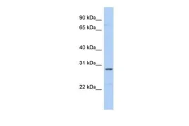 Anti-SNRPA1 antibody, N-term used in Western Blot (WB). GTX47384