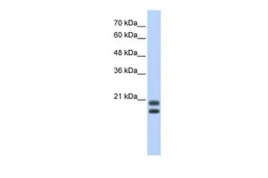 Anti-Serglycin antibody, Internal used in Western Blot (WB). GTX47391