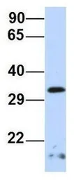 Anti-Gemin2 antibody, Internal used in Western Blot (WB). GTX47412