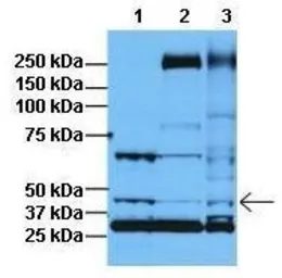 Anti-PRMT8 antibody, C-term used in Western Blot (WB). GTX47431