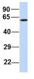 Anti-PRMT7 antibody, N-term used in Western Blot (WB). GTX47432