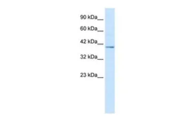 Anti-NUCB2 antibody, C-term used in Western Blot (WB). GTX47488