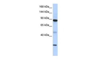 Anti-TDRD9 antibody, Internal used in Western Blot (WB). GTX47495