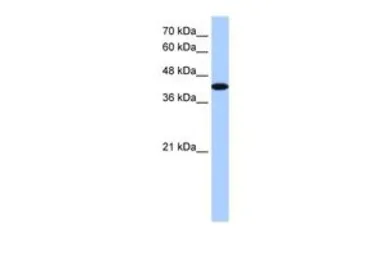 Anti-AKAP7 antibody, Internal used in Western Blot (WB). GTX47527