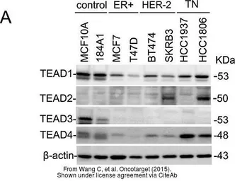 Anti-TEF4 antibody, Internal used in Western Blot (WB). GTX47542
