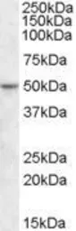 Anti-TEF4 antibody, Internal used in Western Blot (WB). GTX47542