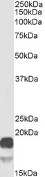 Anti-PBR antibody, C-term used in Western Blot (WB). GTX47548