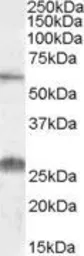 Anti-SLC47A1 antibody, Internal used in Western Blot (WB). GTX47554