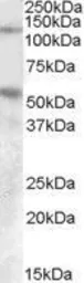 Anti-Palladin (aa895-907) antibody, Internal used in Western Blot (WB). GTX47571