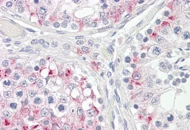 Anti-CPT1C antibody, Internal used in IHC (Paraffin sections) (IHC-P). GTX47577