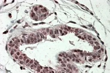 Anti-TREX2 antibody, Internal used in IHC (Paraffin sections) (IHC-P). GTX47594