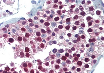 Anti-FOXP2 antibody, C-term used in IHC (Paraffin sections) (IHC-P). GTX47606