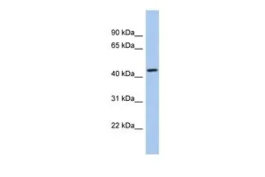 Anti-KCTD10 antibody, Internal used in Western Blot (WB). GTX47647