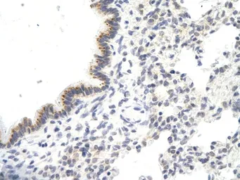 Anti-VDAC3 antibody, N-term used in IHC (Paraffin sections) (IHC-P). GTX47681