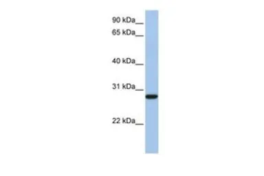 Anti-VDAC3 antibody, N-term used in Western Blot (WB). GTX47681