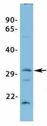 Anti-VDAC3 antibody, N-term used in Western Blot (WB). GTX47681