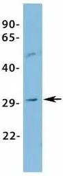 Anti-VDAC3 antibody, N-term used in Western Blot (WB). GTX47681