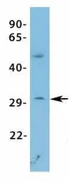 Anti-VDAC3 antibody, N-term used in Western Blot (WB). GTX47681