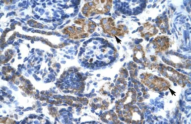 Anti-C4 binding protein B antibody, N-term used in IHC (Paraffin sections) (IHC-P). GTX47750