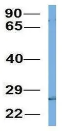 Anti-C4 binding protein B antibody, N-term used in Western Blot (WB). GTX47750