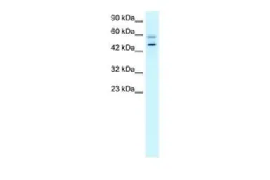 Anti-Vasculin antibody, N-term used in Western Blot (WB). GTX47780