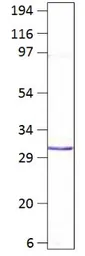 Anti-Aquaporin 8 antibody used in Western Blot (WB). GTX47812