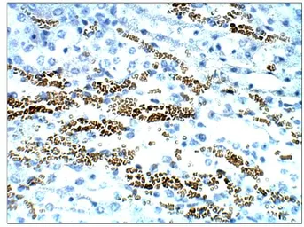 Anti-STRA6 antibody used in IHC (Paraffin sections) (IHC-P). GTX47858