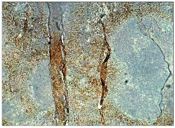 Anti-STRA6 antibody used in IHC (Paraffin sections) (IHC-P). GTX47858