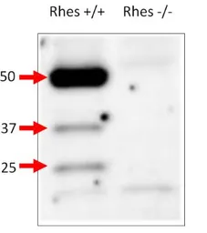 Anti-RASD2 antibody used in Western Blot (WB). GTX47859
