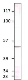 Anti-Aquaporin 4 antibody used in Western Blot (WB). GTX47920