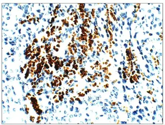 Anti-Aquaporin 1 antibody used in IHC (Paraffin sections) (IHC-P). GTX47931
