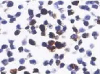 Anti-Renilla Luciferase antibody used in Immunocytochemistry/ Immunofluorescence (ICC/IF). GTX47953