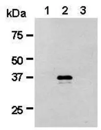 Anti-Renilla Luciferase antibody used in Western Blot (WB). GTX47953