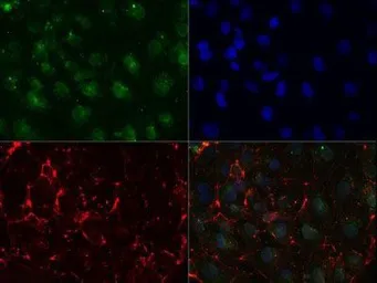 Anti-SSEA-1 / CD15 antibody [MC-480] used in Immunocytochemistry/ Immunofluorescence (ICC/IF). GTX48035